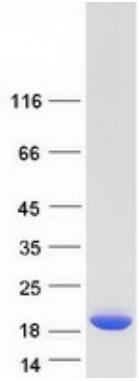 Coomassie blue staining of purified TTR protein.